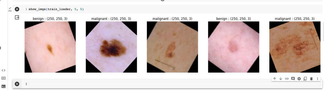 Melanoma Skin Cancer Detection using CNN